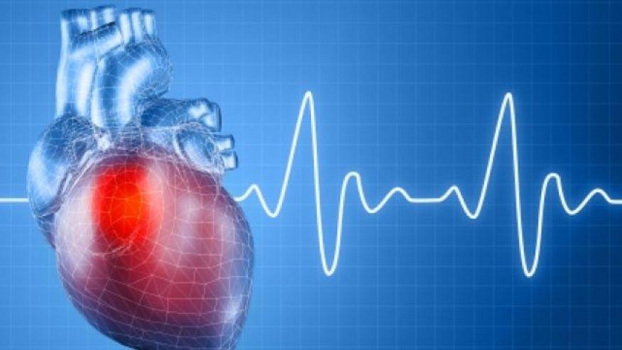 The Most Reliable Way of Determining Heart Attack Risk?